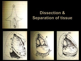 9 April 2015 11Dr.M. B. Bargade
 