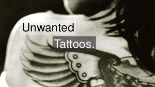 Unwanted
Tattoos.
 