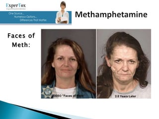 Faces of Meth: 