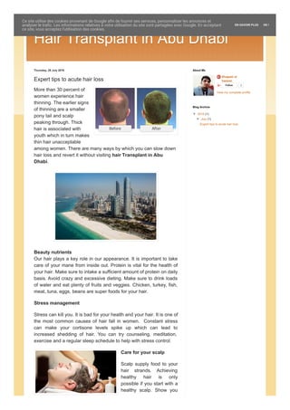 Hair Transplant in Abu Dhabi
Thursday, 28 July 2016
Expert tips to acute hair loss
More than 30 percent of
women experience hair
thinning. The earlier signs
of thinning are a smaller
pony tail and scalp
peaking through. Thick
hair is associated with
youth which in turn makes
thin hair unacceptable
among women. There are many ways by which you can slow down
hair loss and revert it without visiting hair Transplant in Abu
Dhabi.
Beauty nutrients
Our hair plays a key role in our appearance. It is important to take
care of your mane from inside out. Protein is vital for the health of
your hair. Make sure to intake a sufficient amount of protein on daily
basis. Avoid crazy and excessive dieting. Make sure to drink loads
of water and eat plenty of fruits and veggies. Chicken, turkey, fish,
meat, tuna, eggs, beans are super foods for your hair.
Stress management
Stress can kill you. It is bad for your health and your hair. It is one of
the most common causes of hair fall in women. Constant stress
can make your cortisone levels spike up which can lead to
increased shedding of hair. You can try counseling, meditation,
exercise and a regular sleep schedule to help with stress control.
Care for your scalp
Scalp supply food to your
hair strands. Achieving
healthy hair is only
possible if you start with a
healthy scalp. Show you
Shajeeh ul
hassan
Follow 0
View my complete profile
About Me
▼ 2016 (1)
▼ July (1)
Expert tips to acute hair loss
Blog Archive
1 Plus Blog suivant» Créer un blog Connexion
Ce site utilise des cookies provenant de Google afin de fournir ses services, personnaliser les annonces et
analyser le trafic. Les informations relatives à votre utilisation du site sont partagées avec Google. En acceptant
ce site, vous acceptez l'utilisation des cookies.
EN SAVOIR PLUS OK !
 