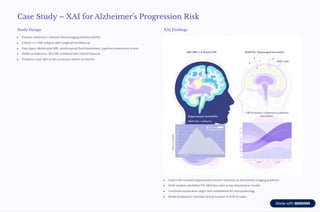 Explainable AI in Neurodegenerative Disease Progression | PDF