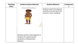 Teaching
Point
Student teacher Behavior Student Behavior Component
s
(Student teacher show diagram to
students for explaining the
symptoms of Kwashiorkor
disease.)
Students watch the diagram
carefully and note down the
content in their notebook.
 