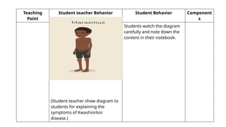 Teaching
Point
Student teacher Behavior Student Behavior Component
s
(Student teacher show diagram to
students for explaining the
symptoms of Kwashiorkor
disease.)
Students watch the diagram
carefully and note down the
content in their notebook.
 