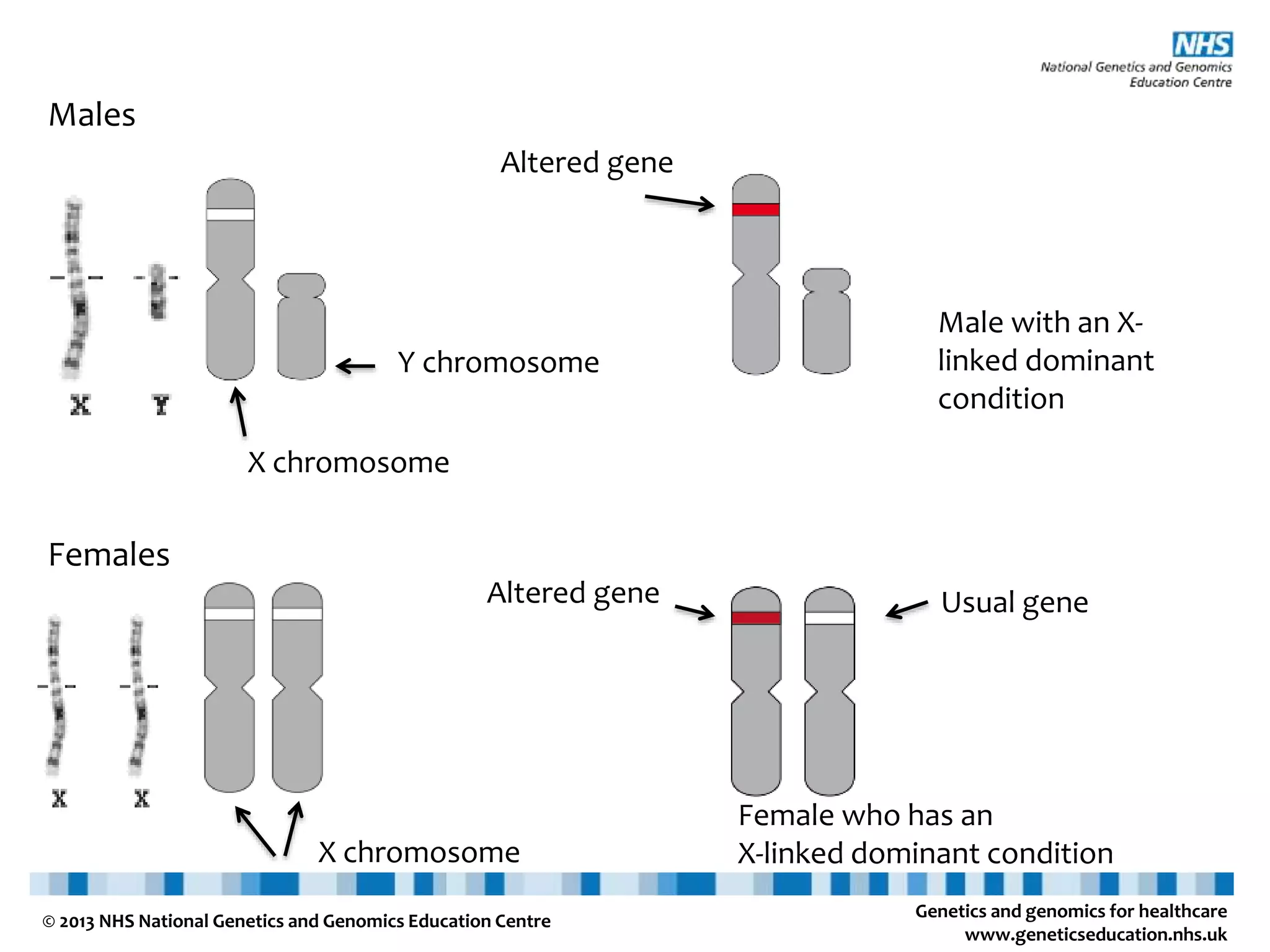 Genetics and genomics for healthcare www.geneticseducation.nhs.uk © 2013 NHS National Genetics and Genomics Education Centre Males X chromosome Y chromosome Females X chromosome Altered gene Male with an X- linked dominant condition Usual geneAltered gene Female who has an X-linked dominant condition 