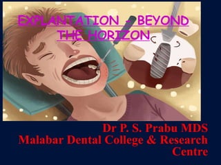 EXPLANTATION - BEYOND
THE HORIZON
Dr P. S. Prabu MDS
Malabar Dental College & Research
Centre
 