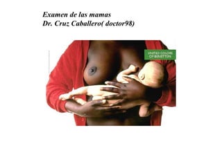 Examen de las mamas Dr. Cruz Caballero( doctor98) 