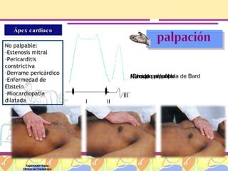 Exploración física Clínica de Cardiología palpación Ápex cardiaco No palpable:  Estenosis mitral Pericarditis constrictiva Derrame pericárdico Enfermedad de Ebstein Miocardiopatía dilatada Normal Choque en cúpula de Bard IV ruido palpable III ruido palpable I II I II I II III 