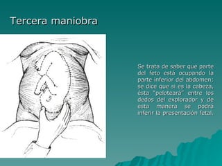 Tercera maniobra Se trata de saber que parte del feto está ocupando la parte inferior del abdomen; se dice que si es la cabeza, ésta “peloteará” entre los dedos del explorador y de esta manera se podrá inferir la presentación fetal.  