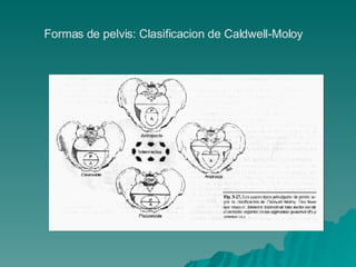 Formas de pelvis: Clasificacion de Caldwell-Moloy 