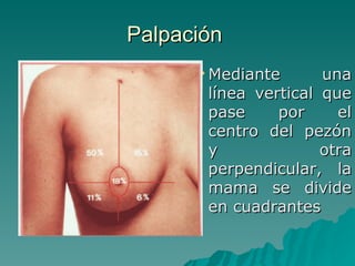 Palpación  Mediante una línea vertical que pase por el centro del pezón y otra perpendicular, la mama se divide en cuadrantes 