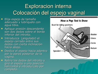 Exploracion interna  Colocación del espejo vaginal Elija espejo de tamaño adecuado y lubríquelo con agua tibia. Aplique presión descendente son dos dedos sobre el borde inferior del introito. Introduzca  (angulado) el espejo cerrado entre sus dedos con cierta inclinación hacia abajo. Deslice el espejo hacia adentro por la pared posterior de la vagina. Retire los dedos del introito y gire el espejo a una posición horizontal e introdúzcalo por completo. 