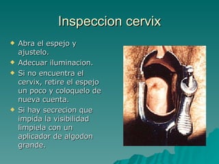 Inspeccion cervix Abra el espejo y  ajustelo. Adecuar iluminacion. Si no encuentra el cervix, retire el espejo un poco y coloquelo de nueva cuenta. Si hay secrecion que impida la visibilidad limpiela con un aplicador de algodon grande. 