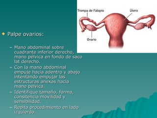 Palpe ovarios: Mano abdominal sobre cuadrante inferior derecho, mano pélvica en fondo de saco lat derecho. Con la mano abdominal empuje hacia adentro y abajo intentando empujar las estructuras anexas hacia mano pélvica. Identifique tamaño, forma, consitencia movilidad y sensibilidad. Repita procedimiento en lado izquierdo. 