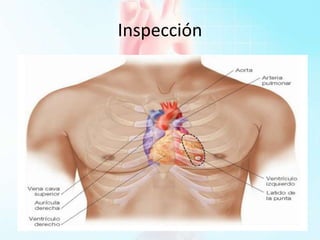 Inspección
 