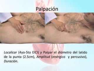 Palpación
Localicar (4yo-5to EICI) y Palpar el diámetro del latido
de la punta (2.5cm), Amplitud (enérgico y percusivo),
Duración.
 