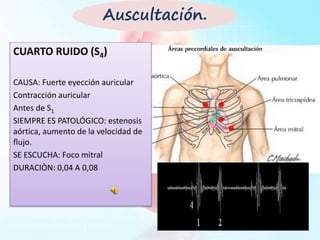 CUARTO RUIDO (S4)
CAUSA: Fuerte eyección auricular
Contracción auricular
Antes de S1
SIEMPRE ES PATOLÓGICO: estenosis
aórtica, aumento de la velocidad de
flujo.
SE ESCUCHA: Foco mitral
DURACIÒN: 0,04 A 0,08
Auscultación.
 