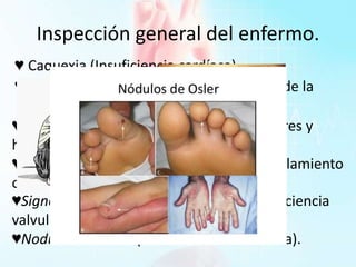 Inspección general del enfermo.
♥ Caquexia (Insuficiencia cardíaca).
♥ Signo de Horner (aneurisma del cayado de la
aorta).
♥Lesiones eritematosas, indoloras, nodulares y
hemorrágicas (Endocarditis).
♥Adopción espontánea de postura encuclillamiento
o genupectoral (derrame pericardico.)
♥Signo de Musset, Roth y de Müller. (insuficiencia
valvular aórtica).
♥Nodulos de Osler. (endocarditis bacteriana).
 