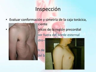 Inspección
• Evaluar conformación y simetría de la caja torácica,
constitución del paciente
• Localizar límites teóricos de la región precordial
– 2do EICD 1 cm por fuera del borde esternal
– Articulación condro-esternal del 5to cartílago
derecho
– 5to EICI a 7-8 cm de la línea media
– 2do EICI a nivel del borde esternal
 