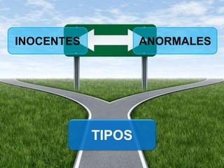 TIPOS
INOCENTES ANORMALES