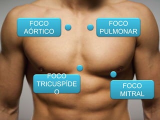 FOCO
AÓRTICO
FOCO
PULMONAR
FOCO
TRICUSPÍDE
O
FOCO
MITRAL