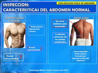 EXPLORACION FISICA DE ABDOMEN
Un surco
mediano poco
acentuado
2 salientes
(músculos de
los canales
vertebrales)
Suave depresión
límite externo
formada por
músculos anchos del
abdomen
Perfil anterior:
ligeramente
sinuoso.
Porción
supraumbilical
Porción
infraumbilical:
Semiología Médica Pedro Cossio año 2004
 