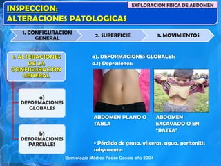 INSPECCION:
ALTERACIONES PATOLOGICAS
EXPLORACION FISICA DE ABDOMEN
1. CONFIGURACION
GENERAL
2. SUPERFICIE 3. MOVIMIENTOS
a)
DEFORMACIONES
GLOBALES
b)
DEFORMACIONES
PARCIALES
a). DEFORMACIONES GLOBALES:
a.1) Depresiones:
- Pérdida de grasa, vísceras, agua, peritonitis
subyacente.
ABDOMEN PLANO O
TABLA
ABDOMEN
EXCAVADO O EN
“BATEA”
Semiología Médica Pedro Cossio año 2004
 