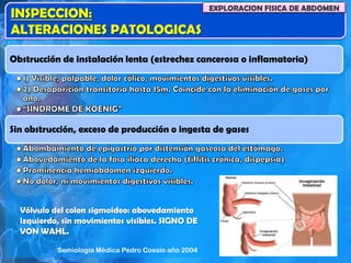 INSPECCION:
ALTERACIONES PATOLOGICAS
EXPLORACION FISICA DE ABDOMEN
Obstrucción de instalación lenta (estrechez cancerosa o inflamatoria)
Sin obstrucción, exceso de producción o ingesta de gases
Vólvulo del colon sigmoideo: abovedamiento
izquierdo, sin movimientos visibles. SIGNO DE
VON WAHL.
Semiología Médica Pedro Cossio año 2004
 