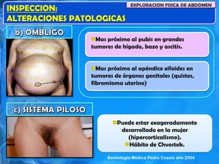 Mas próximo al pubis en grandes
tumores de hígado, bazo y ascitis.
Mas próximo al apéndice xifoides en
tumores de órganos genitales (quistes,
fibromioma uterino)
Puede estar exageradamente
desarrollado en la mujer
(hipercorticalismo).
Hábito de Chvostek.
INSPECCION:
ALTERACIONES PATOLOGICAS
EXPLORACION FISICA DE ABDOMEN
Semiología Médica Pedro Cossio año 2004
 