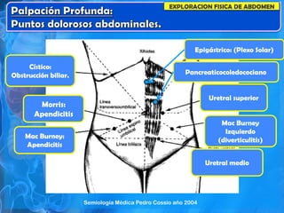 EXPLORACION FISICA DE ABDOMEN
Cístico:
Obstrucción biliar.
Morris:
Apendicitis
Mac Burney:
Apendicitis
Uretral superior
Mac Burney
Izquierdo
(diverticulitis)
Uretral medio
Epigástrico: (Plexo Solar)
Pancreaticocoledocociano
Semiología Médica Pedro Cossio año 2004
 