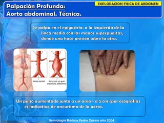 EXPLORACION FISICA DE ABDOMEN
Semiología Médica Pedro Cossio año 2004
 