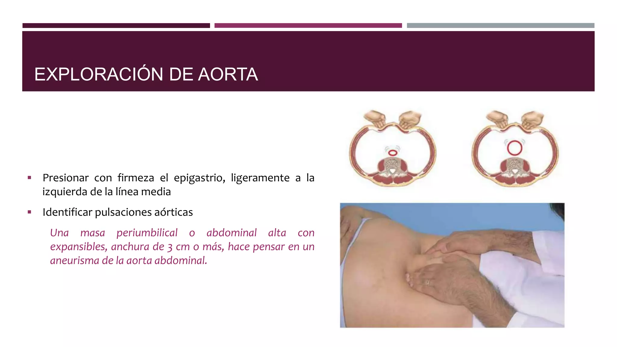 Exploración de abdomen | PPTX