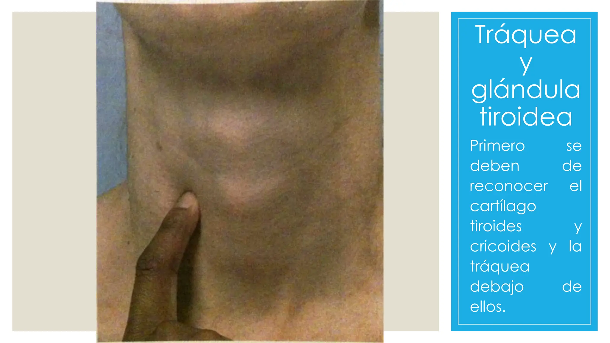 Tráquea
y
glándula
tiroidea
Primero se
deben de
reconocer el
cartílago
tiroides y
cricoides y la
tráquea
debajo de
ellos.
 