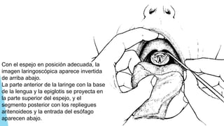 Con el espejo en posición adecuada, la
imagen laringoscópica aparece invertida
de arriba abajo.
La parte anterior de la laringe con la base
de la lengua y la epiglotis se proyecta en
la parte superior del espejo, y el
segmento posterior con los repliegues
aritenoideos y la entrada del esófago
aparecen abajo.
 