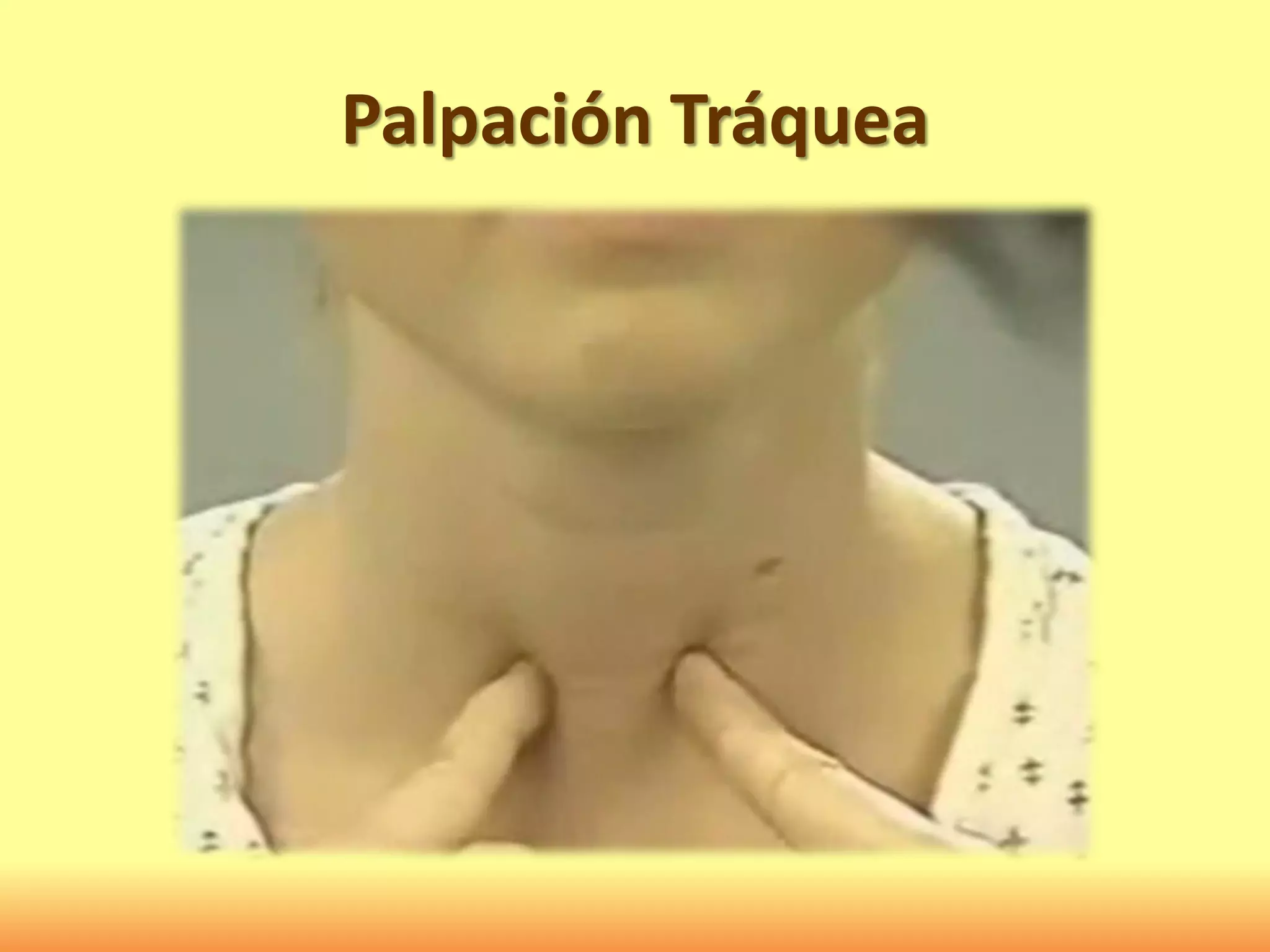 Palpación Tráquea