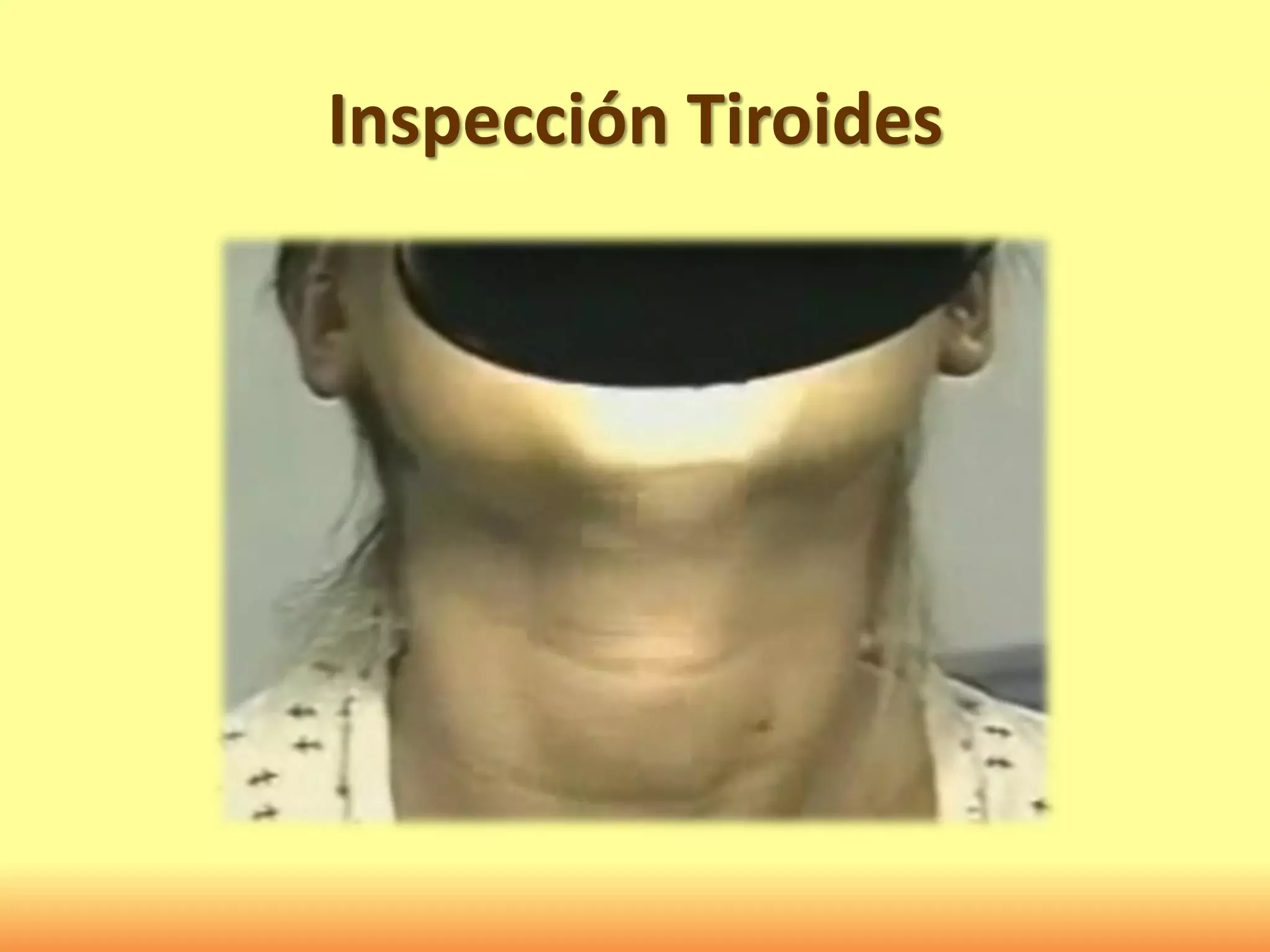 Inspección Tiroides