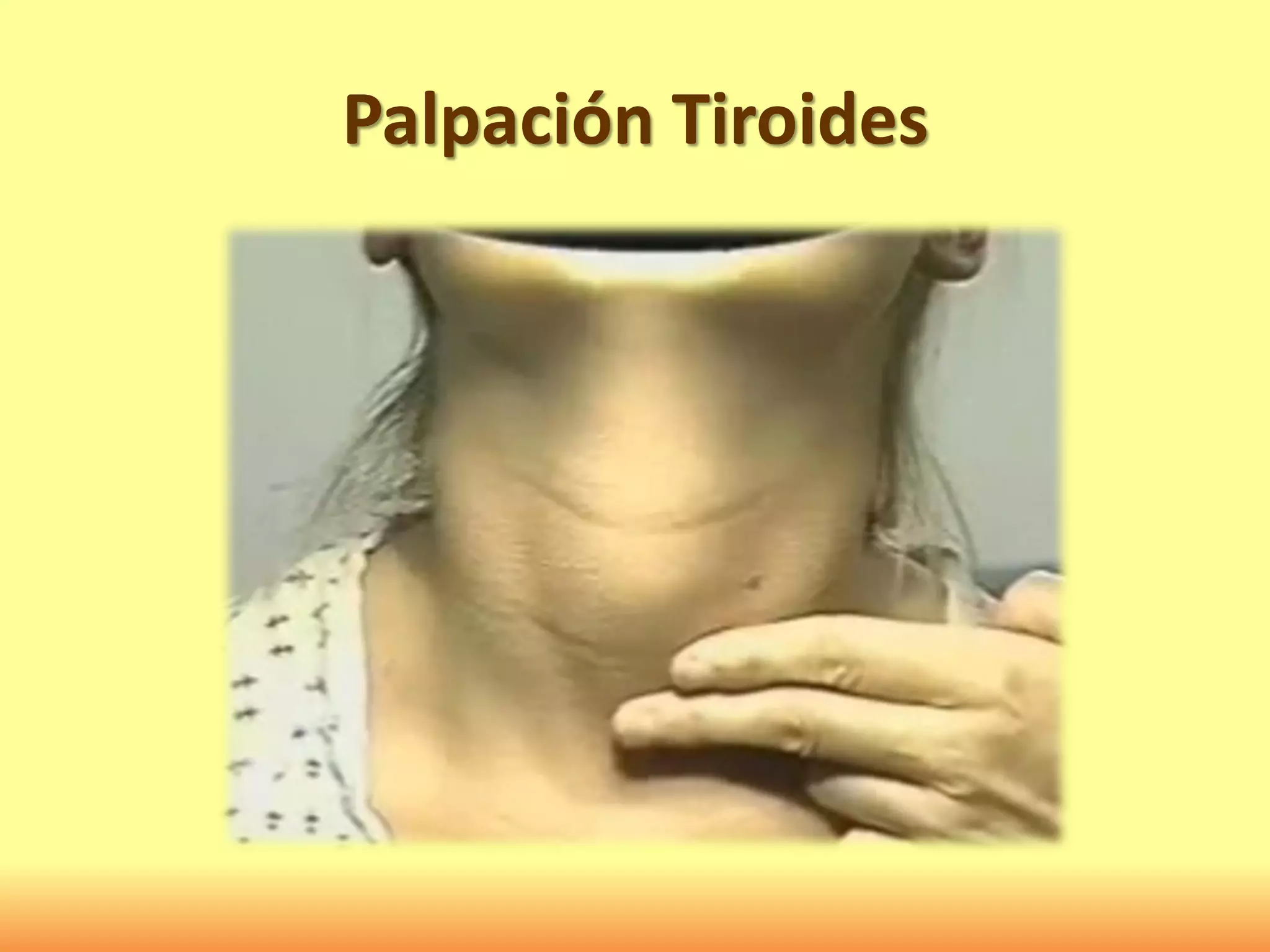Palpación Tiroides