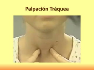 Palpación Tráquea
 