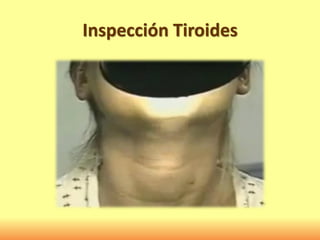 Inspección Tiroides
 