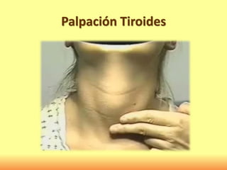 Palpación Tiroides
 