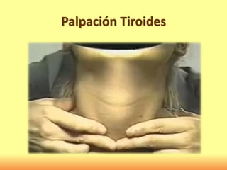 Palpación Tiroides
 