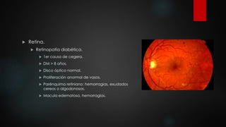  Retina. 
 Retinopatía diabética. 
 1er causa de cegera. 
 DM > 8 años. 
 Disco óptico normal. 
 Proliferación anormal de vasos. 
 Parénquima retiniano: hemorragias, exudados 
cereos o algodonosos. 
 Macula edematosa, hemorragias. 
 