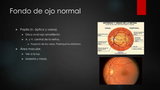 Fondo de ojo normal 
 Papila (n. óptico y vasos). 
 Disco oval rojo amarillento. 
 A. y V. central de la retina. 
 Trayecto de los vasos. Parénquima retiniano. 
 Área macular. 
 Ver a la luz. 
 Molestia y miosis. 
 