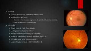  Retina. 
 Vasos, distribución, paredes y parénquima. 
 Parénquima retiniano. 
 Rosado o marrón claro (pigmento de epitelio, diferencias raciales). 
 Libre de exudados o hemorragias. 
 Macula. 
 Parte central. Visión fina del ojo. 
 Adelgazamiento de la retina. 
 Fóvea central con conos y sin capilares. 
 Foveola (depresión central). Agudeza de 20/20. 
 Mirada hacia la luz de exploración. 
 Aspecto pigmentado y con reflejo foveal. 
 