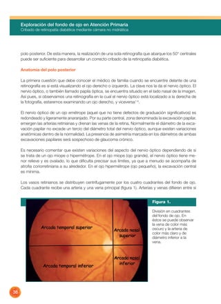 Exploración del fondo de ojo en atención primaria