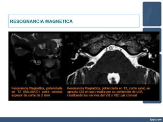 RESOGNANCIA MAGNETICA
 