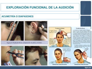 EXPLORACIÓN FUNCIONAL DE LA AUDICIÓN
ACUMETRÍA O DIAPASONES
 