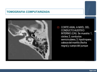 TOMOGRAFIA COMPUTARIZADA
 