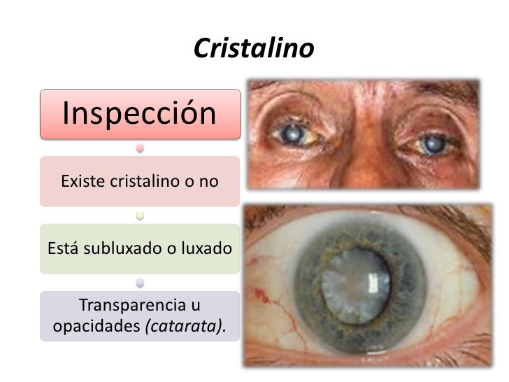 Exploración del paciente en oftalmología Exploración del paciente en oftalmología