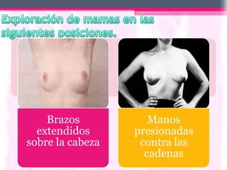 Brazos           Manos
  extendidos      presionadas
sobre la cabeza    contra las
                    cadenas
 