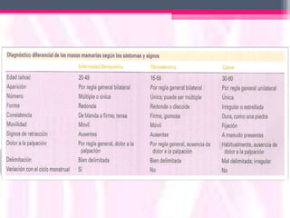 Exploración de mamas